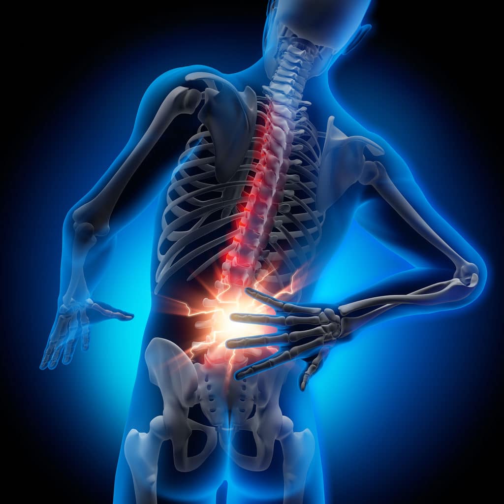 Rückenschmerzen verhindern